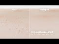 Epiliatorius SES9-341 Braun Silk•épil + FS1000 mini skustuvas