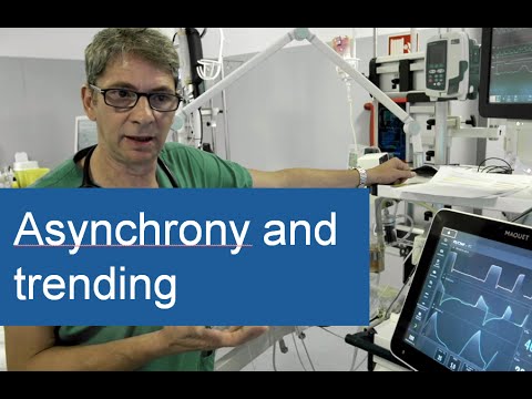 #7 of 9, Edi - vital sign, asynchrony and trending, bedside education with Dr Muttini