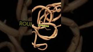 Download lagu How Many People REALLY Die From Roundworm Every Year? #roundworm #parasite mp3