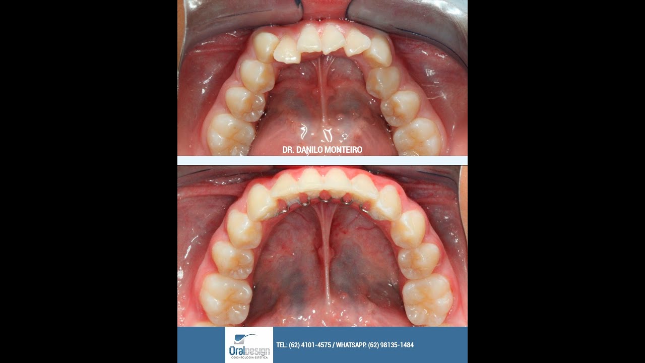 Danilo Monteiro Rezende Pereira-24