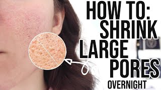 How To Get Rid Of Large Pores OVERNIGHT !!