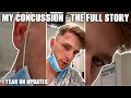 MY CONCUSSION STORY | WHAT ACTUALLY HAPPENED!?