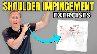 4 Shoulder Impingement Exercises You Can Do at Home