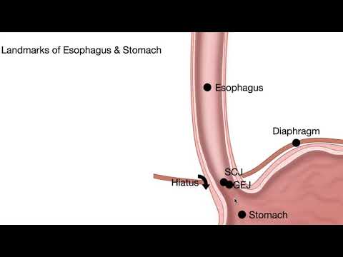 1475-1. Lesson-Esophagus-Anatomy