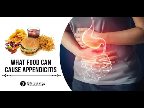Appendicitis: Causes, Symptoms, and Treatment [With Essential Food Tips]