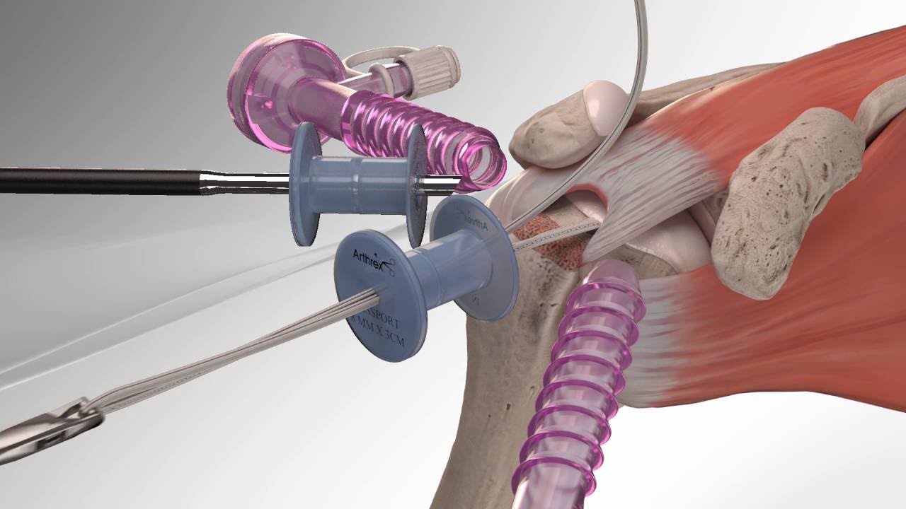 Luis Alberto Buendia Saavedra-22