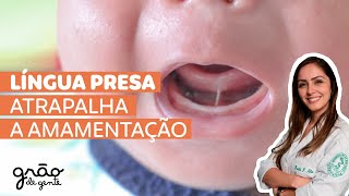 LÍNGUA PRESA ATRAPALHA A SUCÇÃO DO BEBÊ? ENTENDA ❗