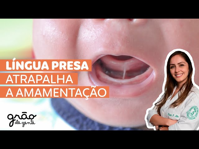 LÍNGUA PRESA ATRAPALHA A SUCÇÃO DO BEBÊ? ENTENDA ❗