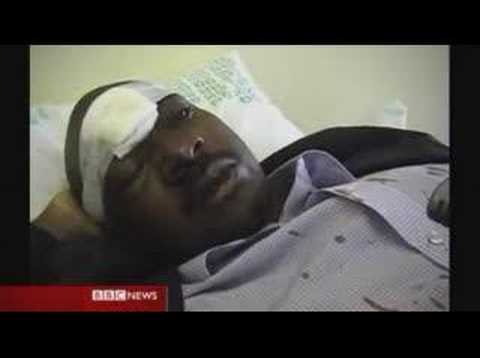 Mugabe's Rival In Brutal Attack