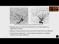 CNS Vasculitis