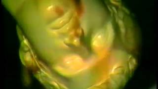 The Mr. T Experience - &quot;At Gilman Street&quot;