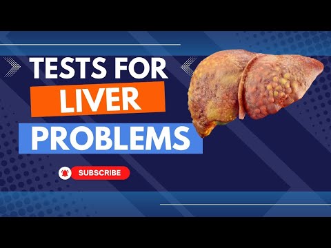 Urine test se kya pata chalta hai Qualitative analysis of urine Urinalysis test