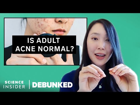 美容專家揭穿19個護膚誤區 (Beauty Experts Debunk 19 Skin-Care Myths)