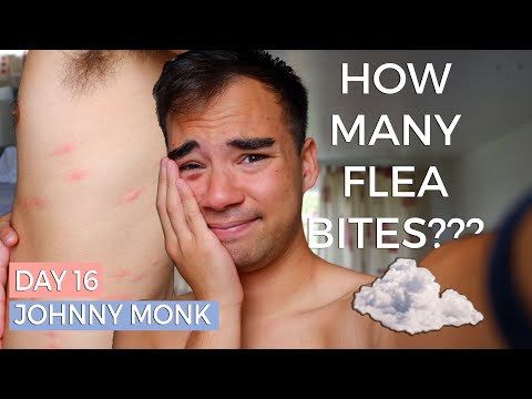 Day 16/ 31 | HOW MANY FLEA BITES DO I HAVE? | You'll never guess...