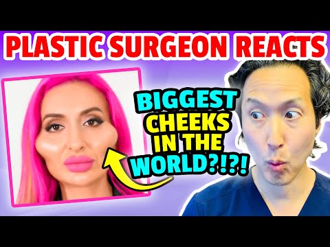 The Largest Implants In Us Extreme Bodies Explained