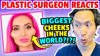 The LARGEST Cheeks in the World! EXTREME Bodies EXPLAINED!