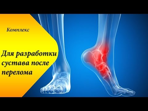 Болит спина выше поясницы когда сижу Остеохондроз рук зарядка