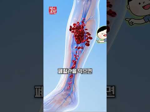 AI가 병원 가지 말고 쉬라고 했는데 폐색전증? ???? 죽을 뻔한 실화 오픈AI 소송 #건강 #shorts