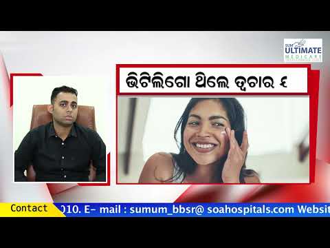 Dr Rajesh Ranjan Panda delves deep into the disease Vitiligo