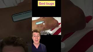 BED BUGS EXPLAINED IN UNDER 60 SECONDS #shorts #medical #doctor #bedbugs