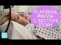 Placenta Previa C-Section Birth Story | Channel Mum