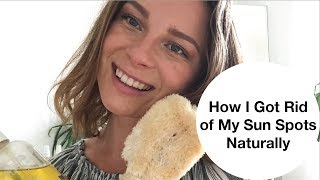 How I Got Rid of My Sun Spots, Naturally  |  5 Top Tips To Get Rid of Sun Spots