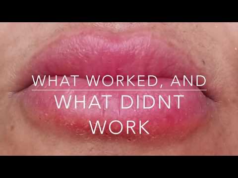 download lagu mp3 mp4 Eos Lip Balm Reaction Treatment, download lagu Eos Lip Balm Reaction Treatment gratis, unduh video klip Eos Lip Balm Reaction Treatment