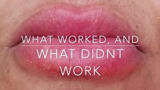 Cure a LIP Allergy! Big swollen, cracked & painful lips!! What works, what doesn