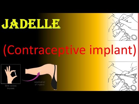 Jadelle | Two Rod Implant | Contraceptive Implant (Insertion and Removal Techniques)