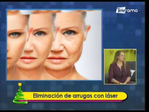 Estética al Día: Eliminación de arrugas con láser 