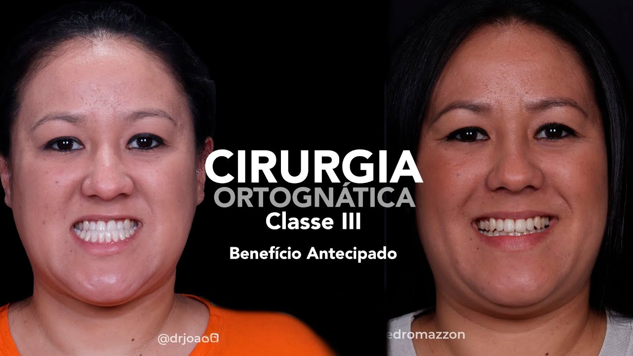 João Pedro Paulino Mazzon-82