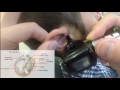 Examination of the External Ear