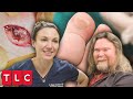 What's the Huge Lump on Tony's Big Toe? Dr. Emma Investigates | Save My Skin