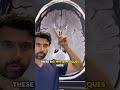 OPTIC NERVE MISTERY #shorts  #doctor #eyedoctor #eyecondition #eyes #ophthalmologist #eyemovement
