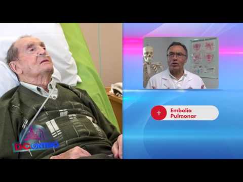 Embolia Pulmonar