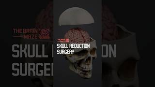 Skull Reduction Surgery