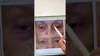 Nava Face & Eye