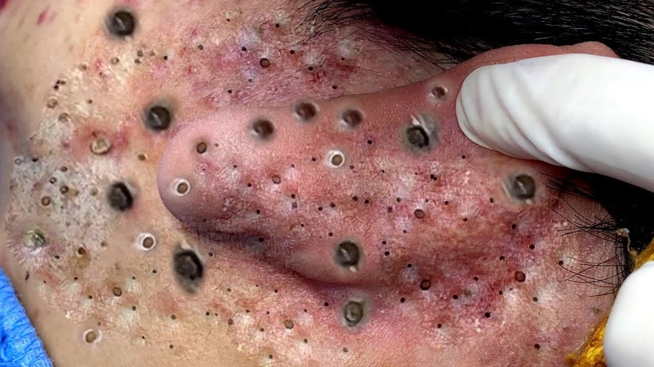 YouTube Thumbnail Downloader FULL HQ IMAGE