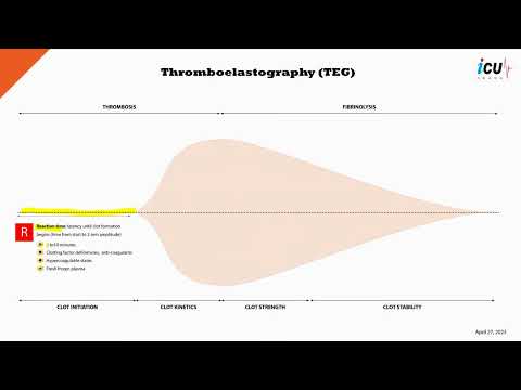 Thromboelastography (TEG) Explained