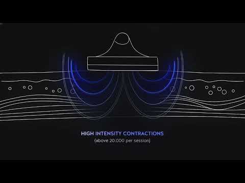 SCHWARZY - DEKA laser - Lumea remodelării corporale intră într-o nouă eră.