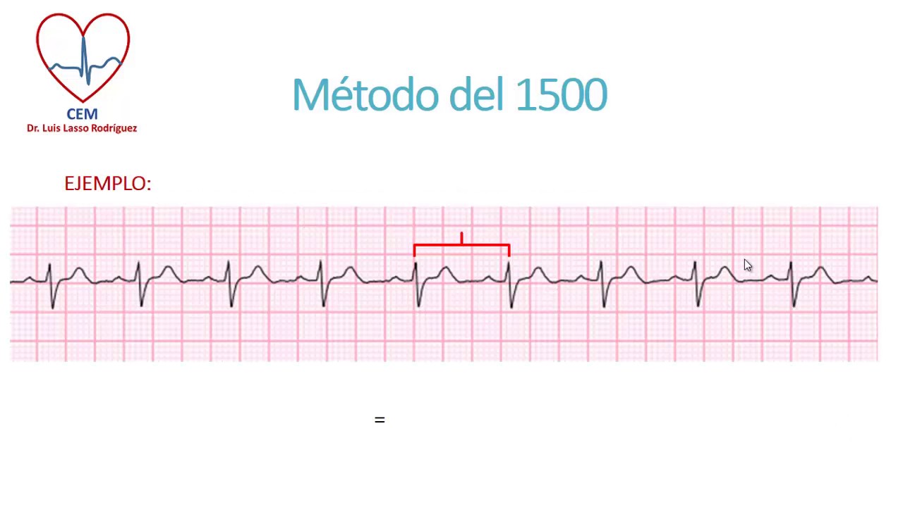 Calculo de la frecuencia cardíaca en un ECG