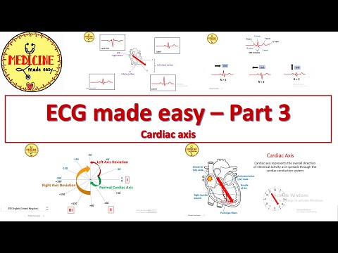 ECG made easy - Part 3/ Cardiac axis