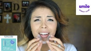 Smile Direct Club Review: Tray 1!