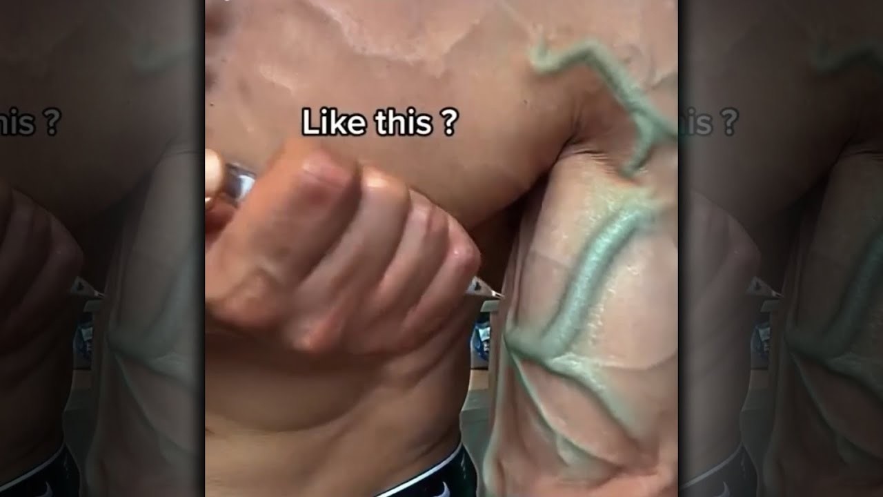 "Bro Destroyed His Arm..." 🤦‍♂️