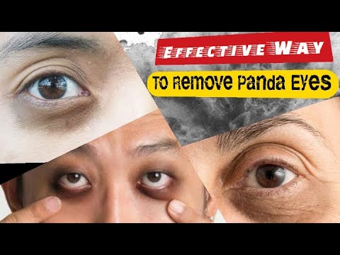 , title : 'Most Effective Way To Remove Dark Circles Under The Eyes Like Panda Eyes / Bestie Health'
