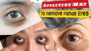 Most Effective Way To Remove Dark Circles Under The Eyes Like Panda Eyes / Bestie Health