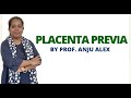 Placenta Previa II B Sc Nursing 4th Year II Gynecology II Anju Madam II