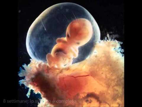 Loperazione avviene alla sostituzione del ginocchio Retrotserebellyarnaya cisti della colonna vertebrale cervicale