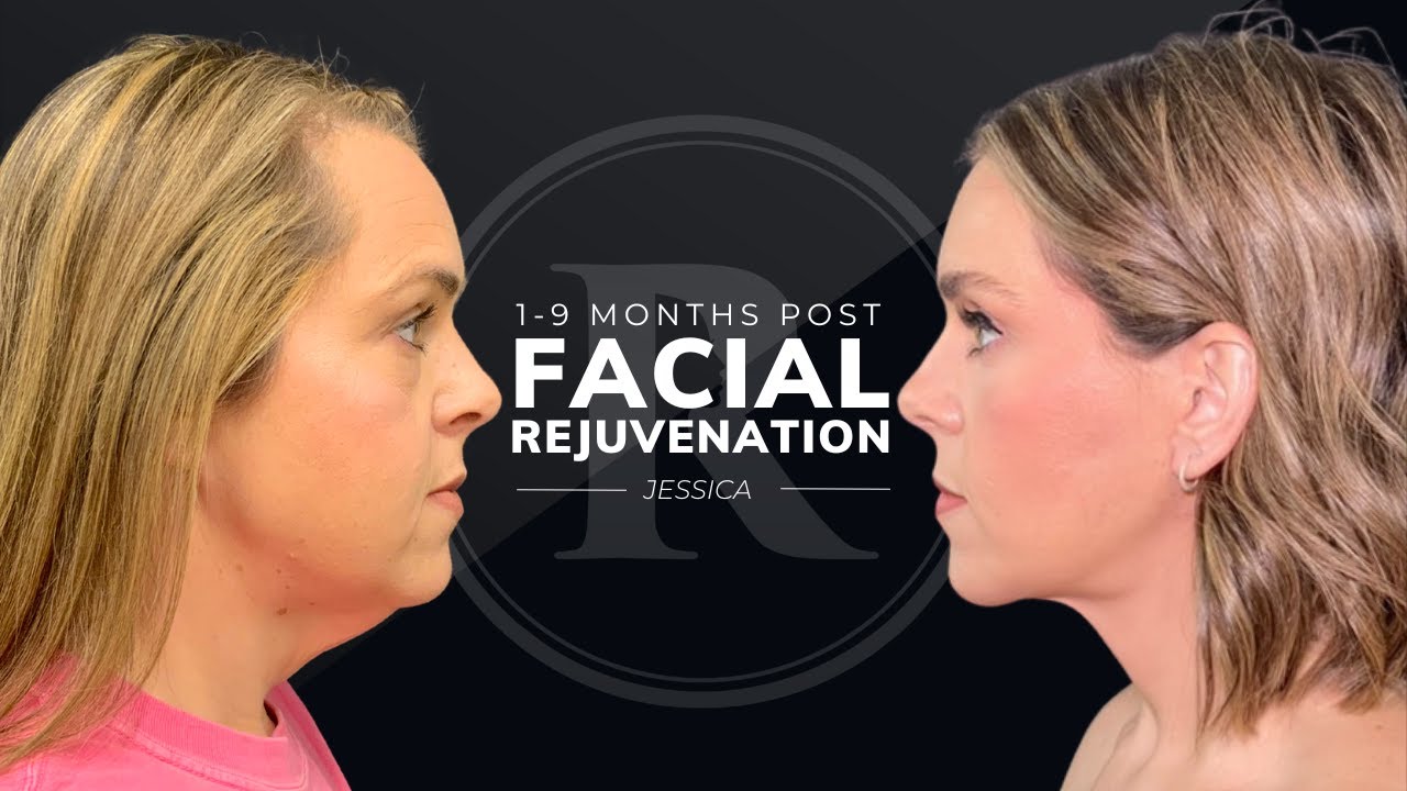Robb Facial Plastic Surgery