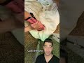 Cast Removal At Home